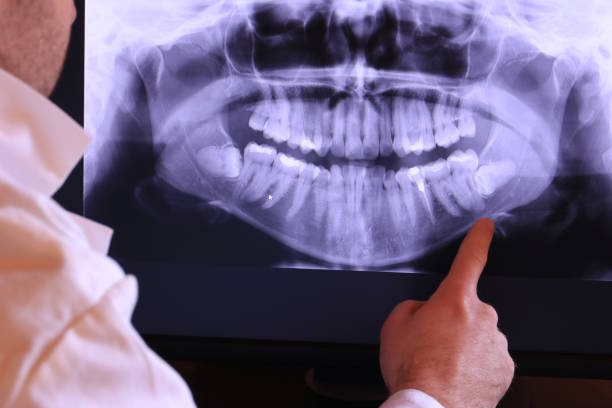 Best Mobile Emergency Dentist in Red Bay, AL